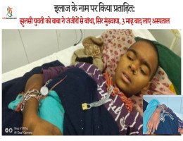 इलाज के नाम पर किया प्रताड़ित: झुलसी युवती काे बाबा ने जंजीराें से बांधा, सिर मुंडवाया, 3 माह बाद लाए अस्पताल